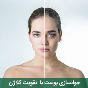 کلاژن